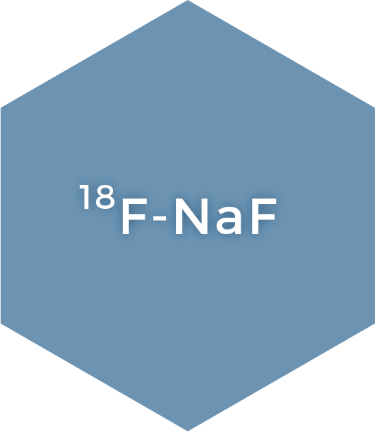 ¹⁸F-NaF
