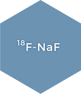 ¹⁸F-NaF