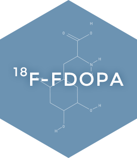 ¹⁸F-FDOPA